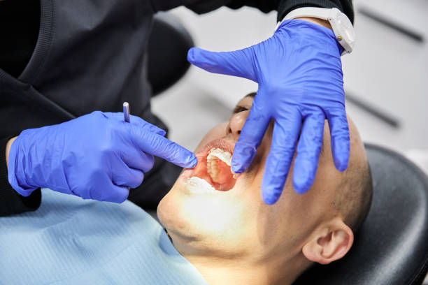 Best Emergency Tooth Extraction in Overlea, MD